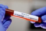 Petice ke koronaviru patří mezi nejhloupější texty, tvrdí Kubek. ‚Nedělejme zbytečné testy,‘ říká Šmucler