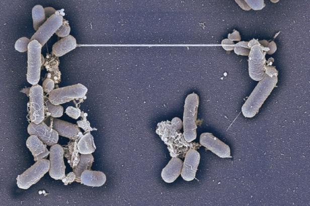 

Čeští a slovenští vědci popsali, jak umírají bakterie. Vystřelují nanotrubičky

