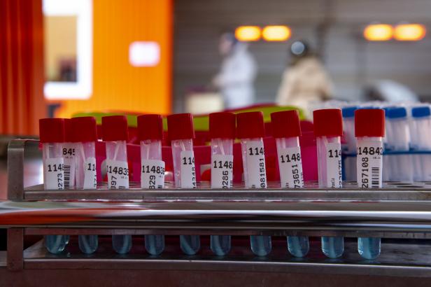 

Systém povolí očkovaným jen dva hrazené PCR testy, nárok má přitom být na pět

