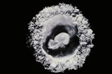 V USA se narodila dvojčata z embryí, která byla zmražená 30 let