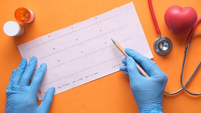 Klasifikace Elektrokardiogramu (EKG) jako služba