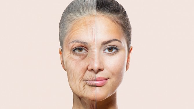 Za rychlé stárnutí kůže mohou naše zlozvyky